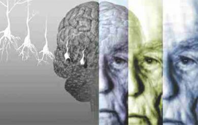 Treatment of Alzheimer’s Disease in Ayurveda