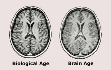 Brain Age vs Biological Age: Why Your Brain May Age Faster