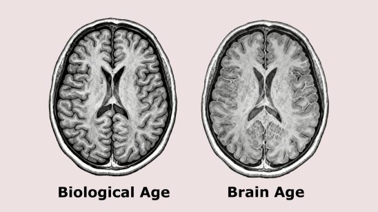 Brain Age vs Biological Age: Why Your Brain May Age Faster