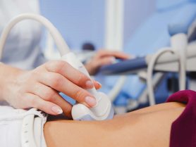 Natural IVF vs Conventional IVF: What Women Should Know